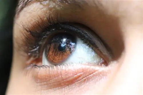 Анатомия зрительного нерва