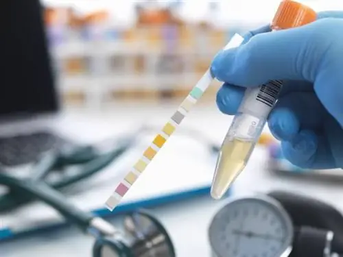 Необычный цвет, запах или внешний вид мочи