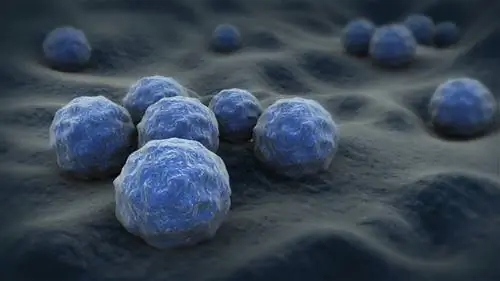 Разница между ЗППП и ИППП