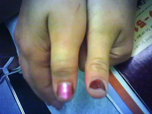 Сравнение одной стороны с другой помогает проиллюстрировать отек