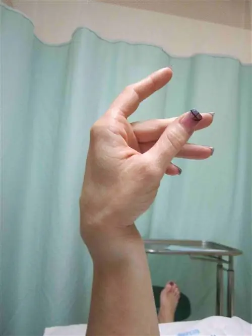 сломанное запястье