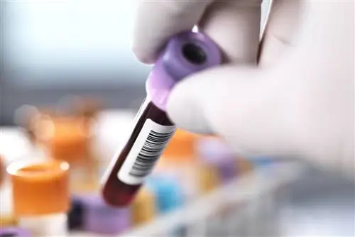 Рука в перчатке держит флакон с кровью со штрих-кодом