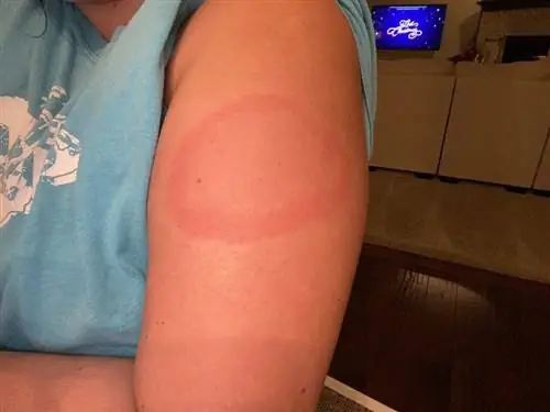 Одна из 12 реакций, описанных в отчете.