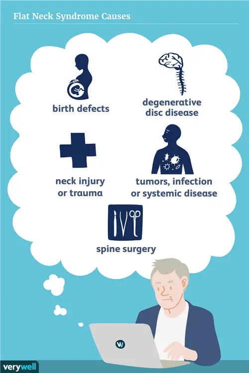 Причины синдрома плоской шеи