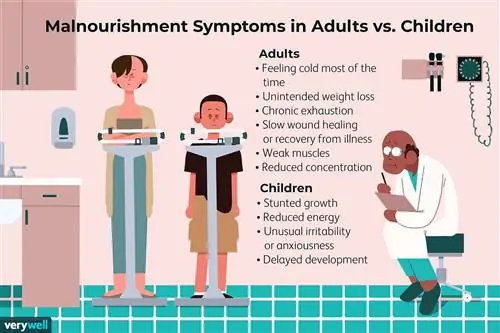 Симптомы недоедания у взрослых и детей