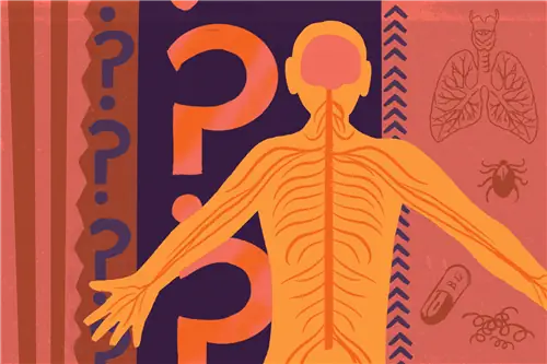 Болезни, которые могут имитировать рассеянный склероз