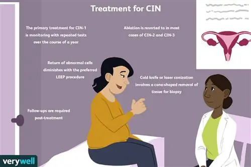 Лечение ЦИН