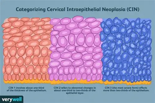 Классификация цервикальной интраэпителиальной неоплазии (CIN)