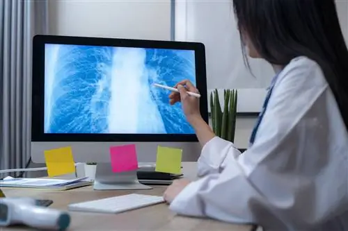 Симптомы синовиальной саркомы