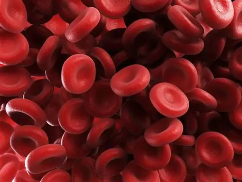 Эритроциты при истинной полицитемии
