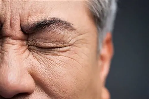 Мужчина закрывает глаза из-за раздражения глаз