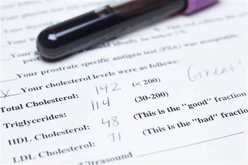 Уровни холестерина указаны на бумаге с пробиркой крови в стороне