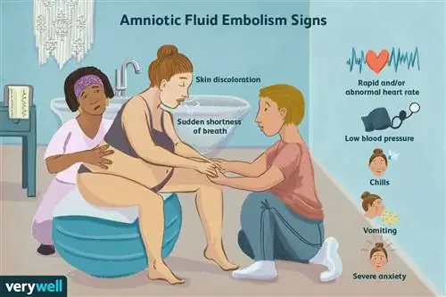 Признаки эмболии околоплодными водами