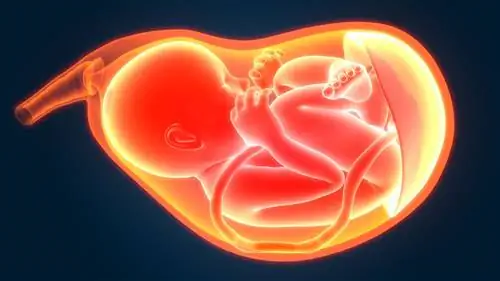 Что такое эмболия околоплодными водами?