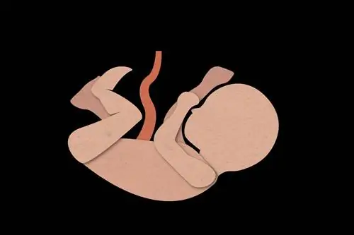 Что такое компрессия пуповины?