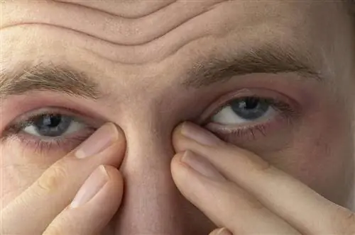 Что такое дакриоцистит (инфекция слезных протоков)?