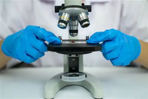 Как диагностируется иммунная тромбоцитопения