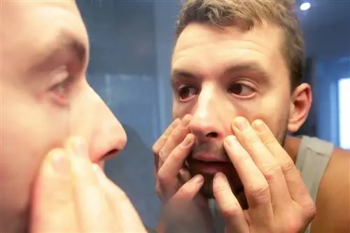 Что такое тревожное расстройство?