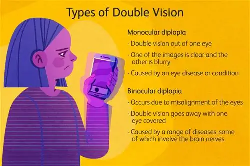 Типы двойного зрения - Иллюстрация Терезы Кьечи