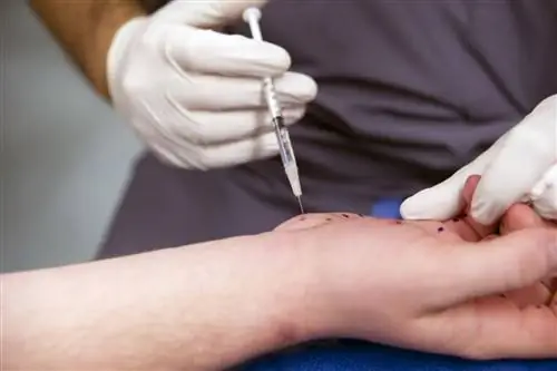 Доктор вводит мужчине руку