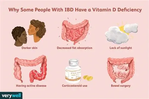 Почему у некоторых людей с ВЗК дефицит витамина D
