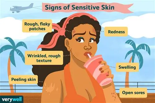 Признаки чувствительной кожи