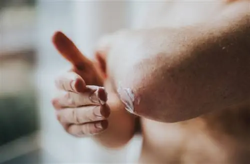 Нанесение крема на рану на локте