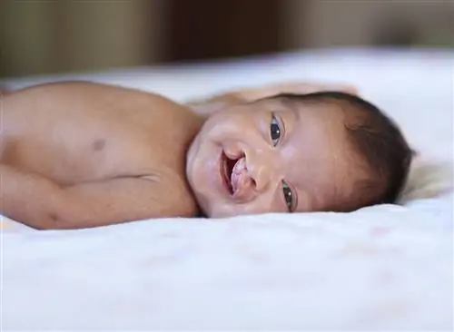 Как ухаживать за ребенком после пластики заячьей губы