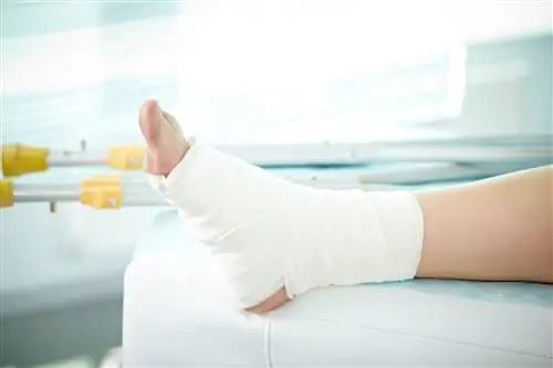 Растяжение стопы