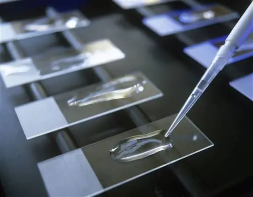 Описание сарком мягких тканей