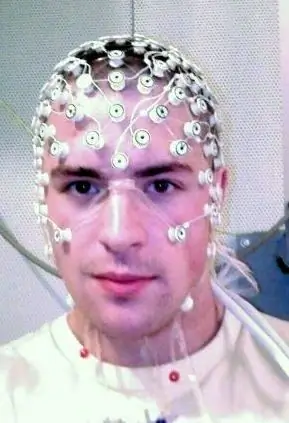 ЭЭГ ЭЭГ