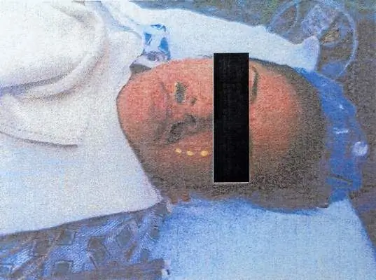 Пациентка Вероника Вальдес подала в суд на мемориальную больницу Торранса за то, что украсила лицо усами во время операции Пациентка Вероника Вальдес подала в суд на мемориальную больницу Торранса за то, что украсила лицо усами во время операции