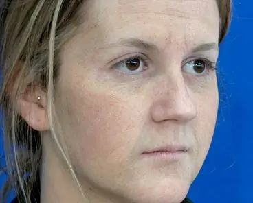 Повышенная скорость метаболизма может привести к ускоренному старению