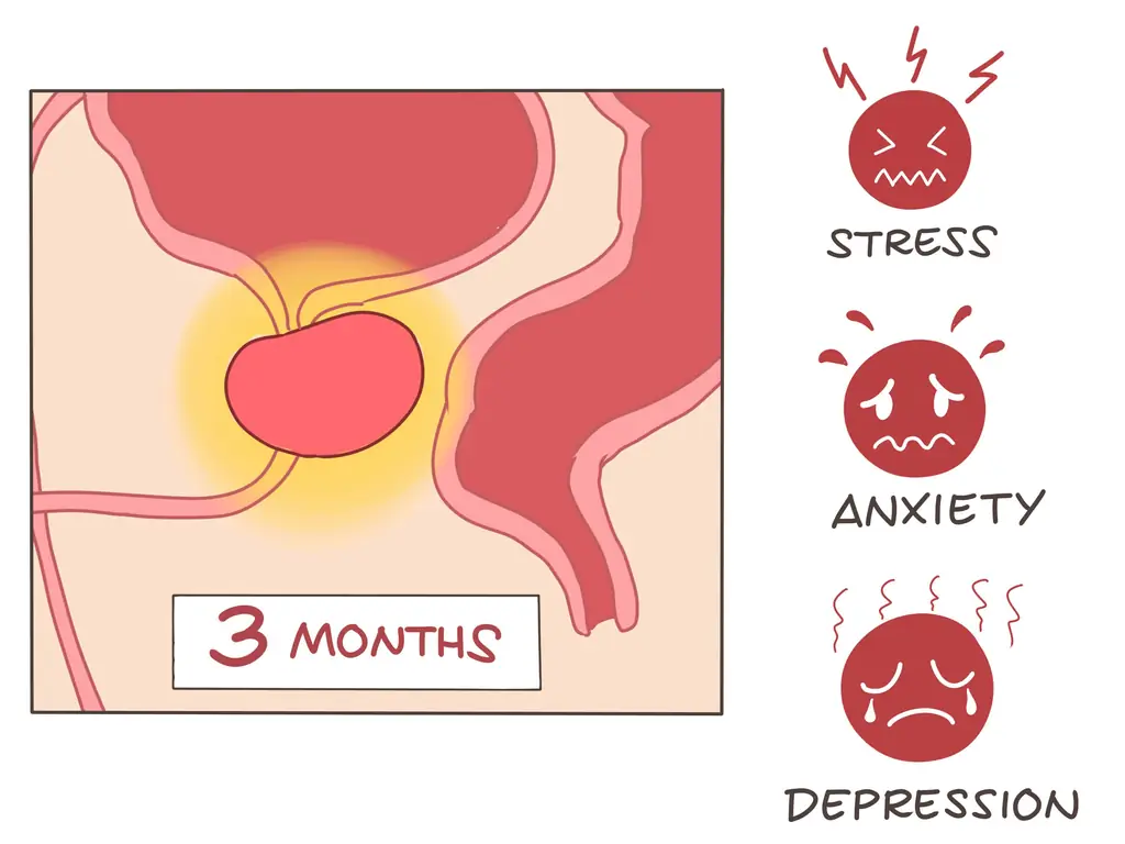 7 способов уменьшить боль в простате
