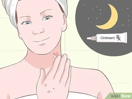 Лечение шрамов от чесотки, шаг 13