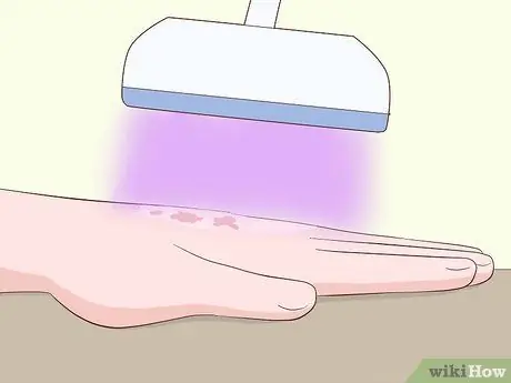 Исцеление шрамов от чесотки, шаг 7