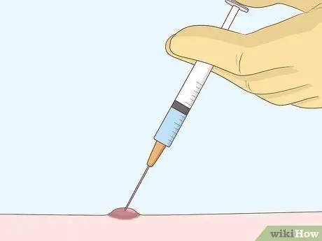 Исцеление шрамов от чесотки, шаг 8