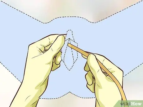 Вставьте катетер Шаг 7