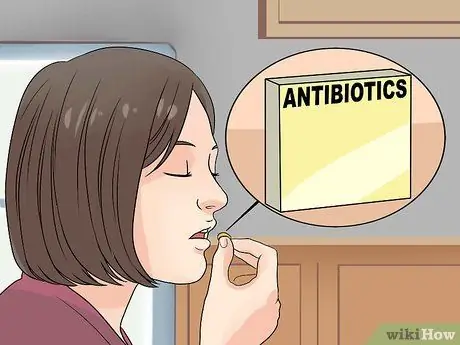 Диагностика розового глаза Шаг 7