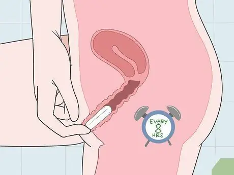Предотвратить утечки во время месячных Шаг 7 Предотвратить утечки во время месячных Шаг 7
