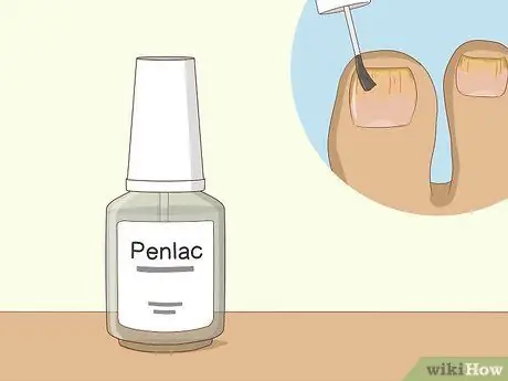 Вылечить грибок ногтей на ногах уксусом Шаг 8