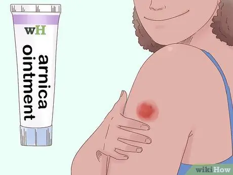 Избавиться от синяков Шаг 11