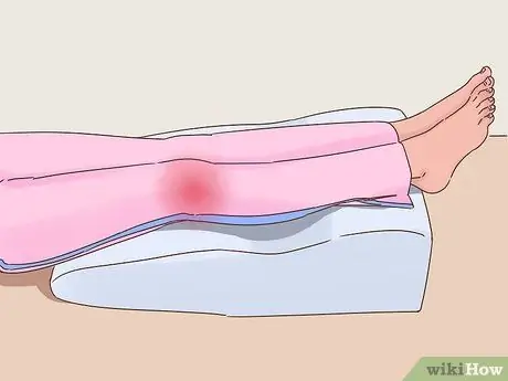 Избавиться от синяков Шаг 2