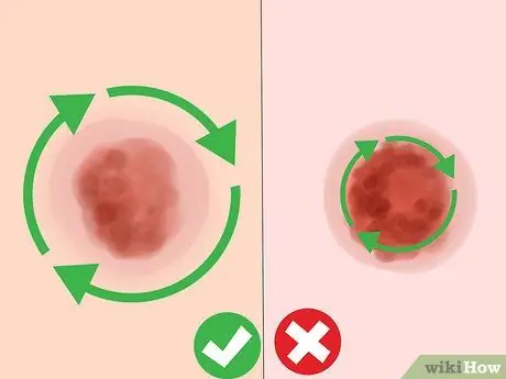 Избавиться от синяков Шаг 8