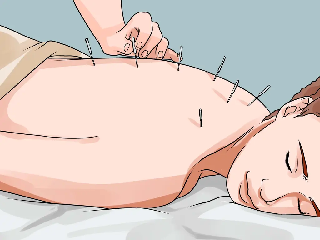 Как исправить сильную ишиасную боль: 13 шагов (с иллюстрациями)