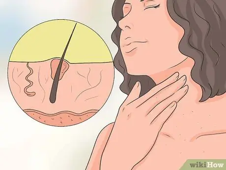 Распознайте симптомы теплового стресса Шаг 5