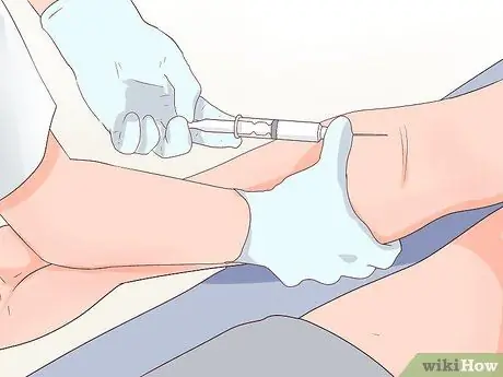 Распознайте симптомы сифилиса Шаг 9