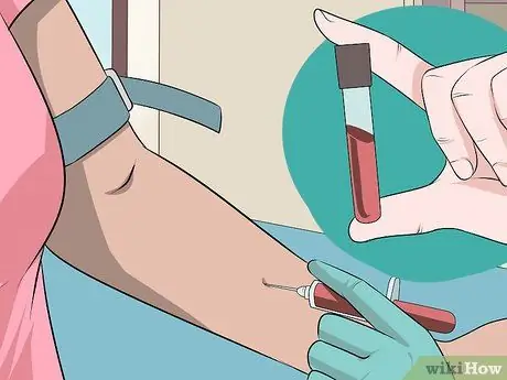 Выявление аппендицита во время беременности Шаг 14