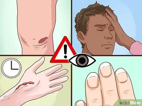 Увеличьте альбумин Шаг 14