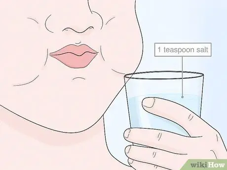 Восстановление после операции на зубах мудрости Шаг 7